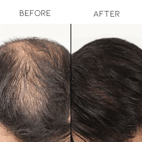 Moisturizing Essence Hair Care Every Day And Night