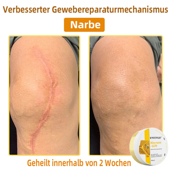Fivfivgo™ Bienengift-Therapie-Creme