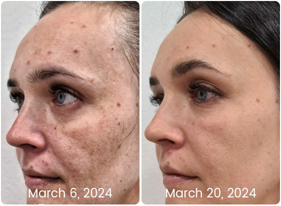 Fivfivgo™ PDRN DNA Reshaping Essence
