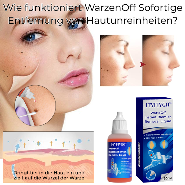 Fivfivgo™ WarzenOff Sofortige Entfernung von Hautunreinheiten