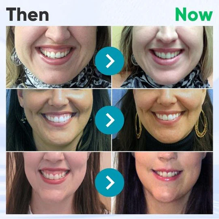 Fivfivgo® Gum Therapy Gel
