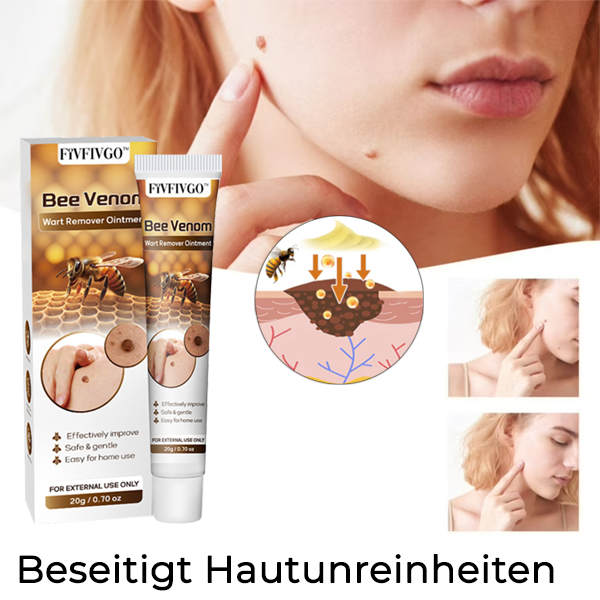 Fivfivgo™ Bienengift-Warzenentferner-Salbe