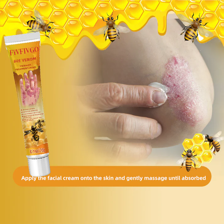 Crème de traitement du psoriasis au venin d'abeille Fivfivgo™