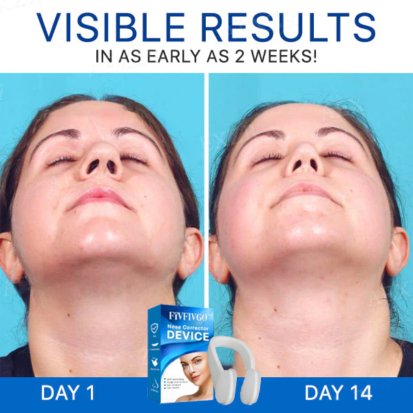 Fivfivgo™ Nose Corrector Device