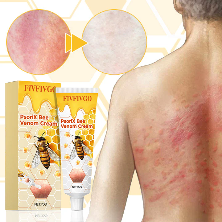 Fivfivgo™ PsoriX Bienengift-Creme