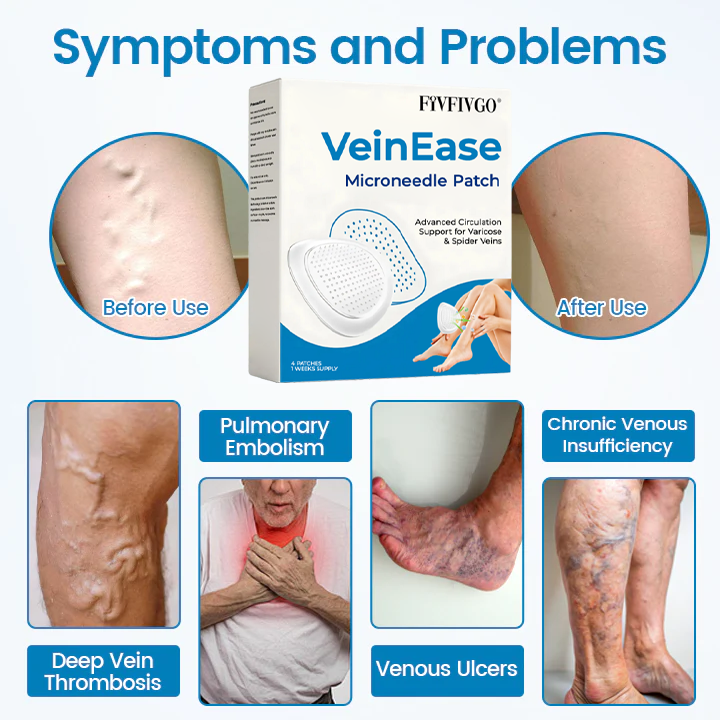 Fivfivgo® VeinEase Microneedle Patch (Advanced Circulation Support for Varicose & Spider Veins)