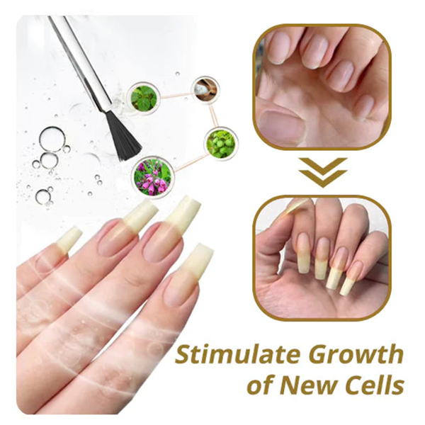 Fivfivgo™ NailGro Intensives Nagelwachstums- und Stärkungsserum