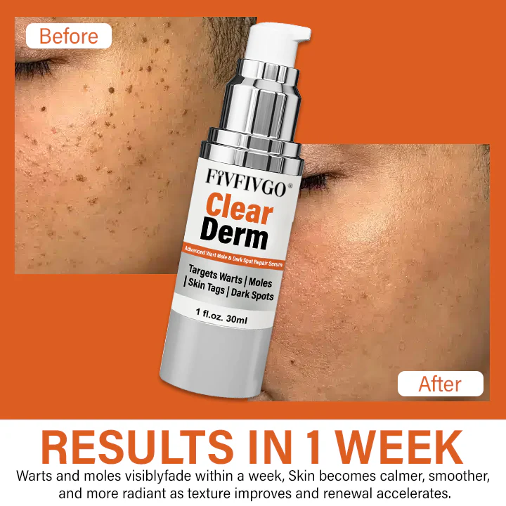 Fivfivgo® ClearDerm Advanced Wart Mole & Dark Spot Repair Serum