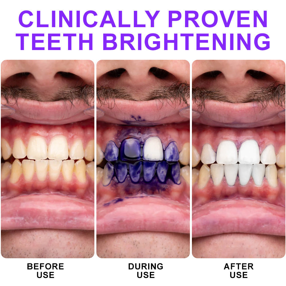 Fivfivgo® Colour Corrector Serum | Clinically proven to gently remove stains, whiten teeth, and restore natural brightness in just 3 days — safe for sensitive teeth and enamel
