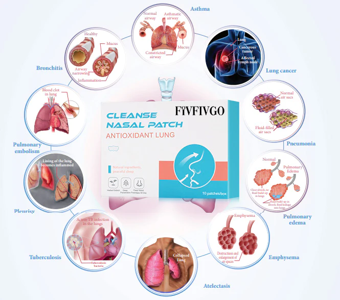 Cerotto nasale antiossidante per la pulizia dei polmoni Fivfivgo™