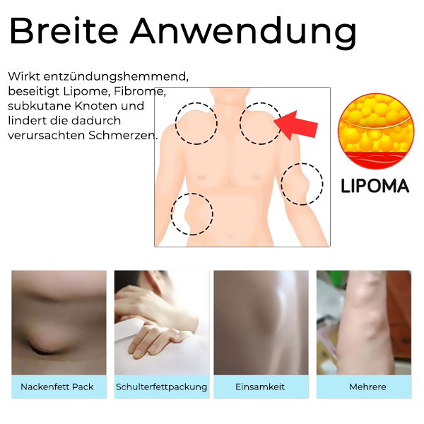 Fivfivgo™ Bioactive Moxibustion Lipom Heilung Stick
