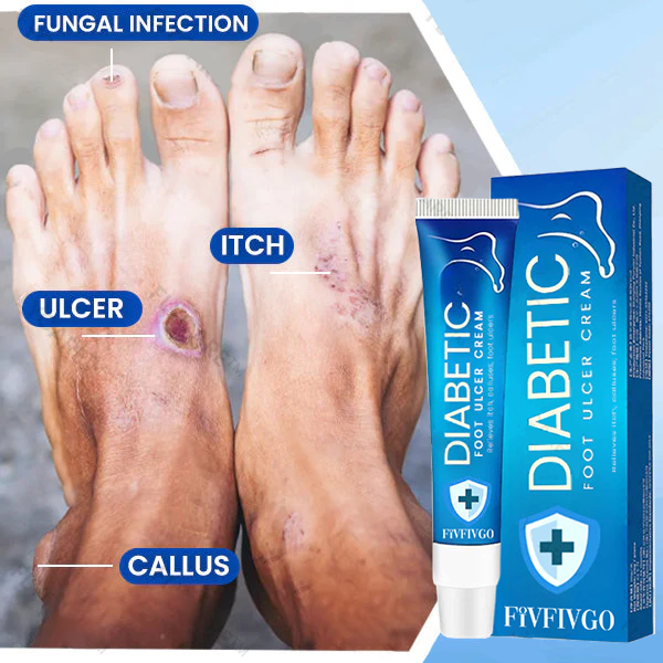 Fivfivgo™ Creme gegen diabetische Fußgeschwüre