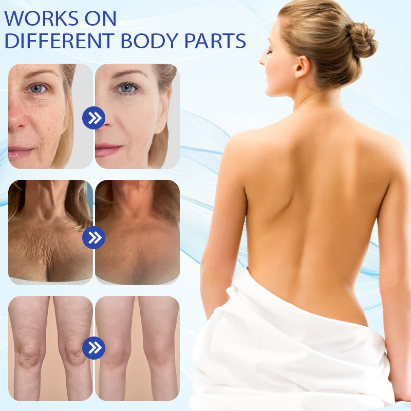 Fivfivgo™ Deep Elastic SkinRenew HA Cream