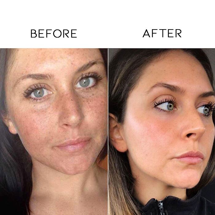 Vitamin C Intense Spot Treatment Skin Care Every Day And Night