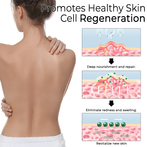 Fivfivgo™ Psoriasis Cure Huile Essentielle