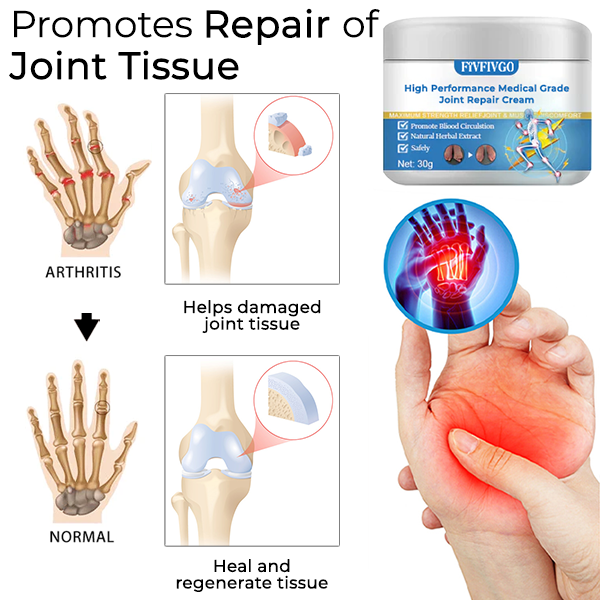 Fivfivgo™ Crema riparatrice per articolazioni di grado medico ad alte prestazioni