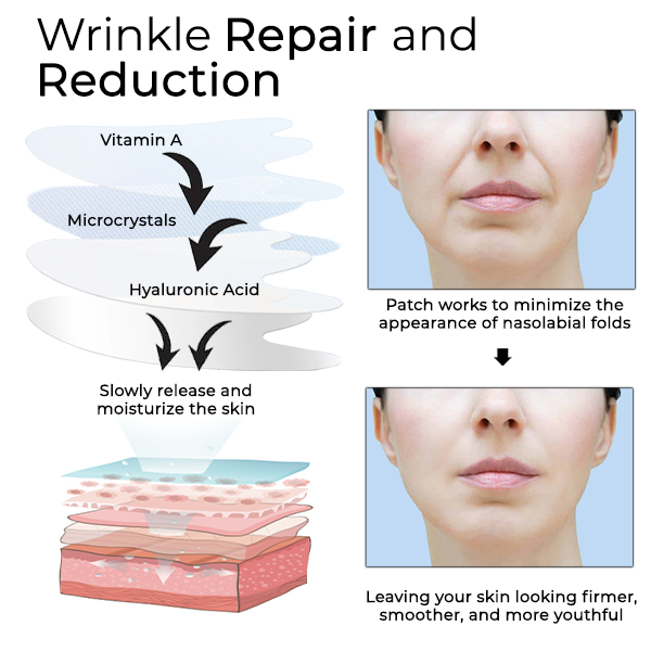 Fivfivgo™ Microcrystal Nasolabial Folds Patch