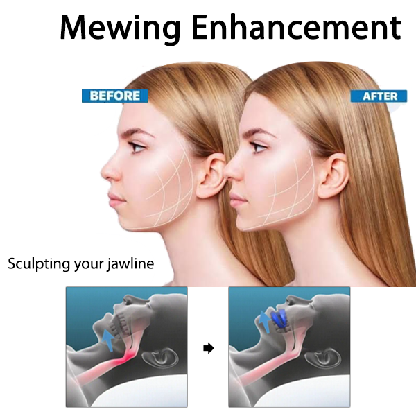 Fivfivgo™ Protecteur de dents anti-ronflement et anti-grincement