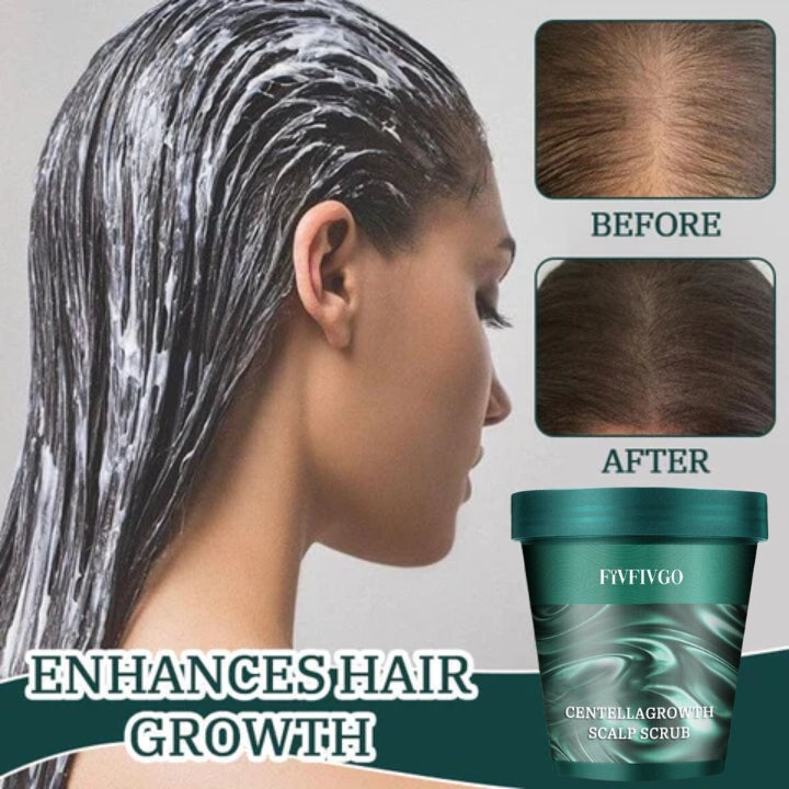 Fivfivgo™ CentellaGrowth Gommage du cuir chevelu