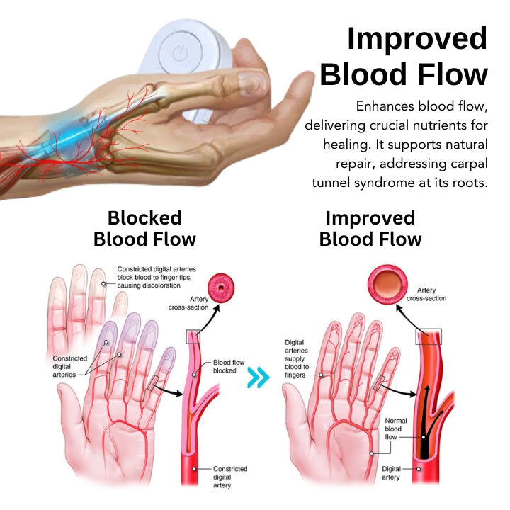 Fivfivgo™ Carpal Tunnel Treatment Device