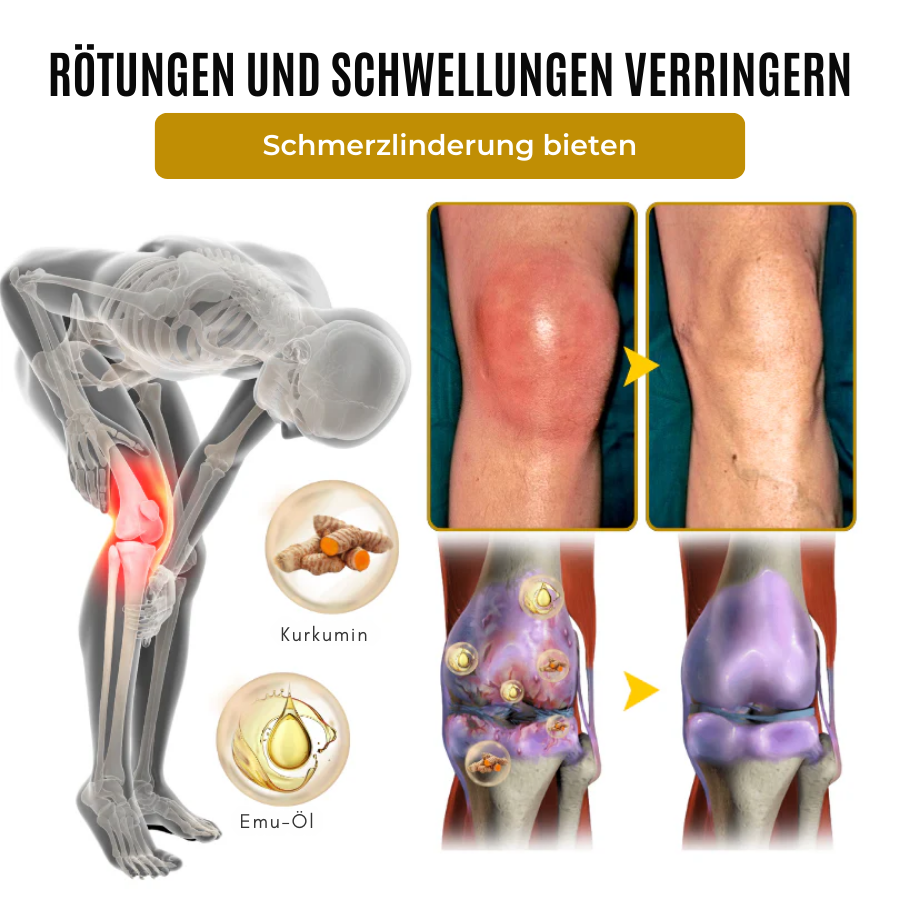 Fivfivgo® ArthroSoothe Kurkuma & Emuöl Schmerzlinderungs-Massagegel