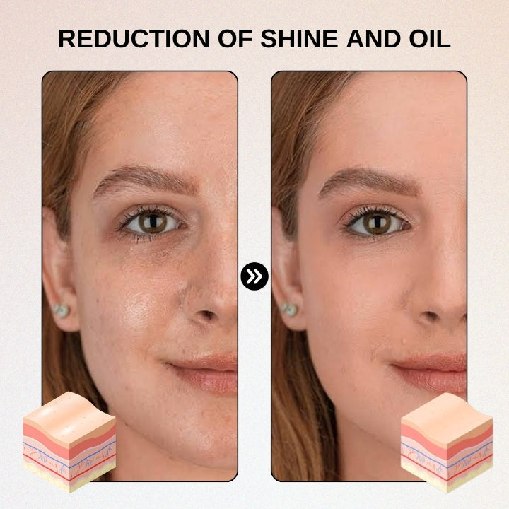 Fivfivgo™ Patch hydrogel pour l'acné