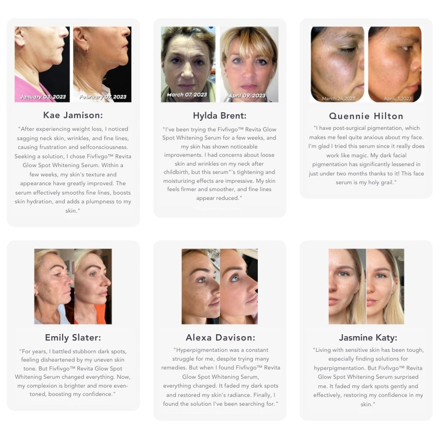 Fivfivgo™ Revita Glow Spot Whitening Serum