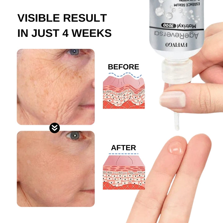 Fivfivgo™ AgeReversa Matrixyl 3000 Essence Sérum
