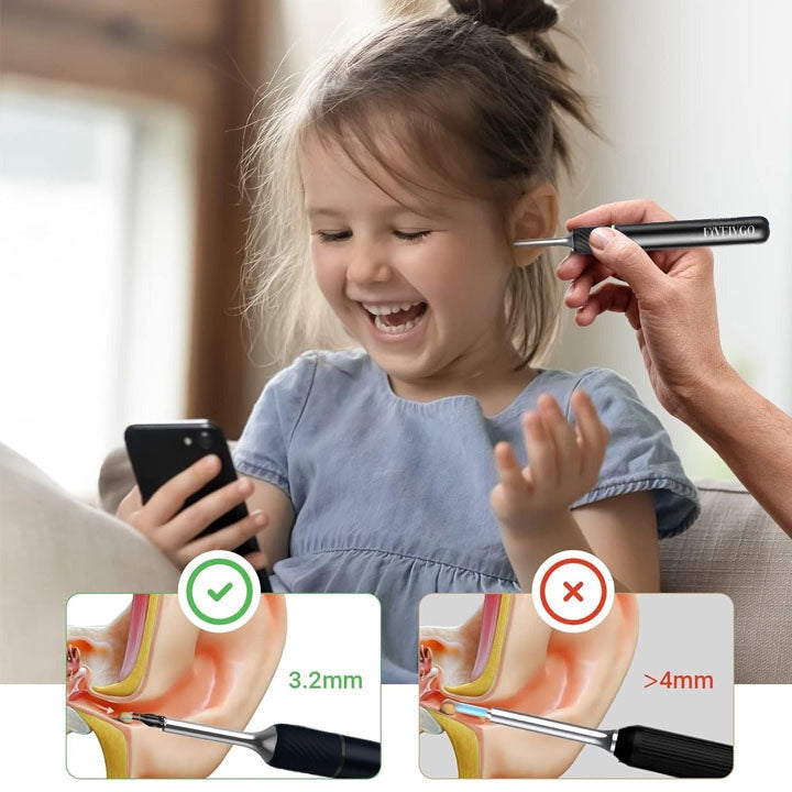 Fivfivgo™ EarWax Clean Pro Otoscope with Wi-Fi Visible Wax Removal Spoon