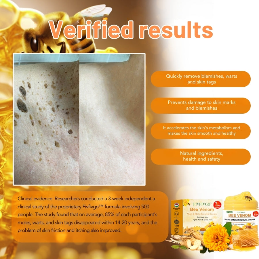 Fivfivgo™ Bee Venom Warts & Blemish Remover