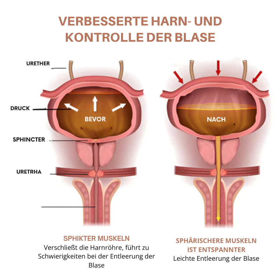 Fivfivgo™ Magnetischer Prostata-Ring aus Kupfer