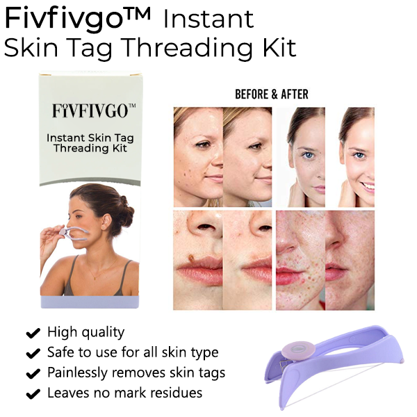 Fivfivgo™ Instant Skin Tag Threading Kit