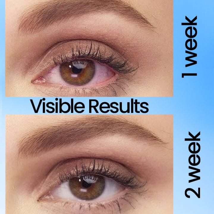 Fivfivgo™ PRO Presbyopia Eye Drops