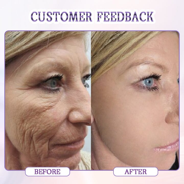 Fivfivgo™ Age-Defying Botulinum Facial Serum