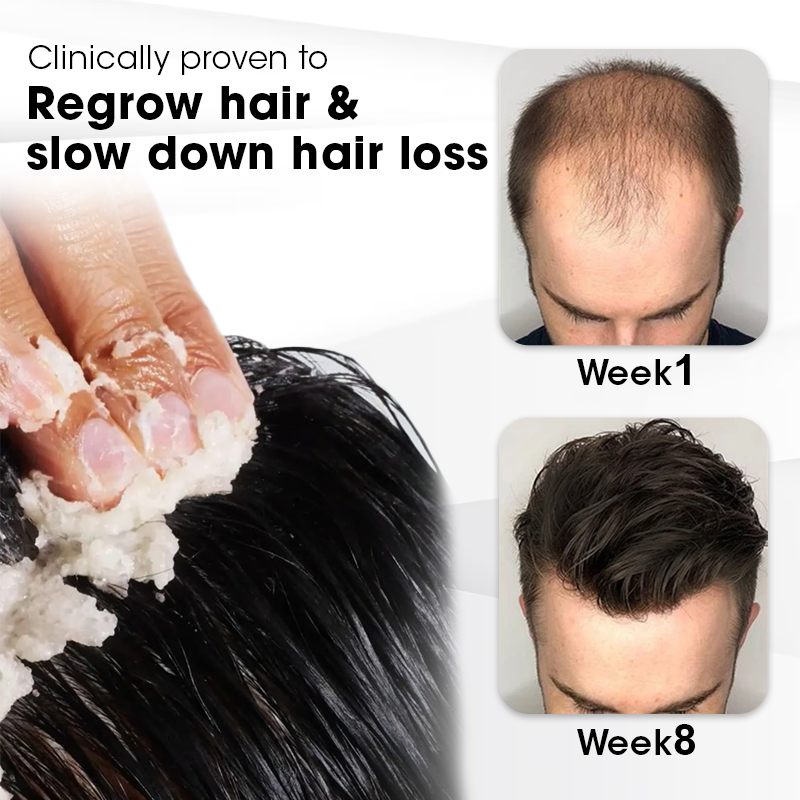Fivfivgo™ Prestige Beach Hair Growth Scrub