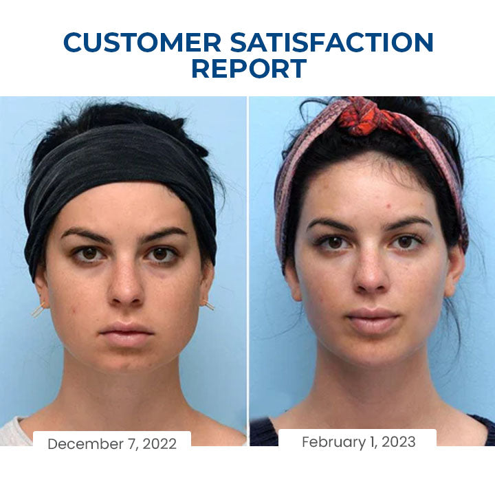 Fivfivgo™ SleepBeauty Face Sculptor