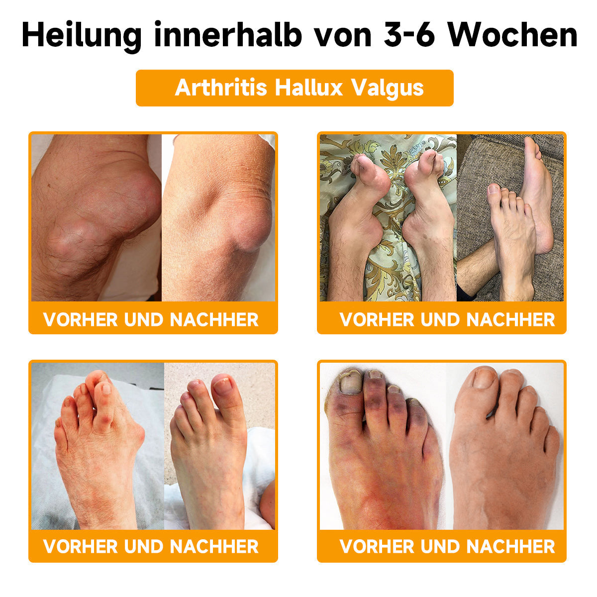 Fivfivgo™ Bienengift- und Kurkuma-Gelenk- und Knochenschmerzlinderungscreme (Spezialisiert auf Gelenk- und Arthritisbeschwerden & empfohlen von der AAOS)
