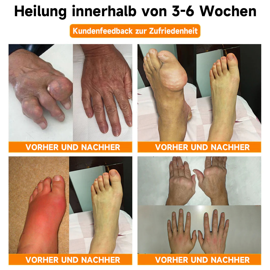 Fivfivgo™ Bienengift- und Kurkuma-Gelenk- und Knochenschmerzlinderungscreme (Spezialisiert auf Gelenk- und Arthritisbeschwerden & empfohlen von der AAOS)