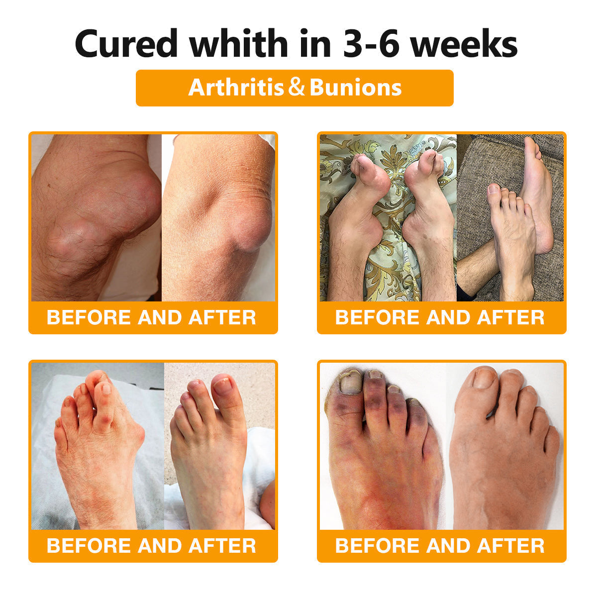 Fivfivgo® Bee Venom and Turmeric Joint and Bone Pain Relief Spray (Specialized in Joint and Arthritis Pain & Recommended by AAOS)