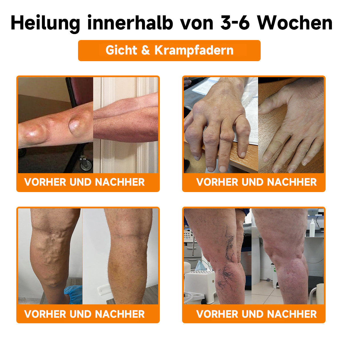 Fivfivgo™ Bienengift- und Kurkuma-Gelenk- und Knochenschmerzlinderungs-Spray (Spezialisiert auf Gelenk- und Arthritisbeschwerden & empfohlen von der AAOS)