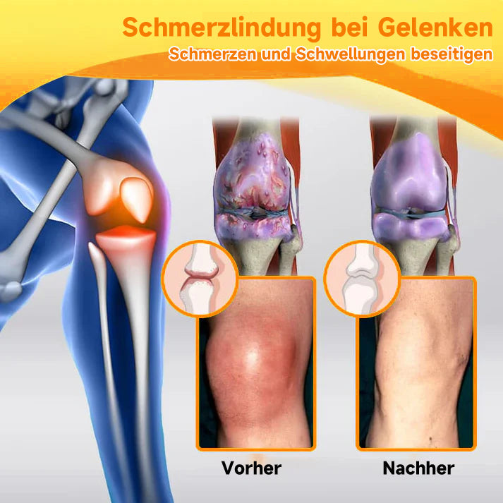 Fivfivgo™ Bienengift- und Kurkuma-Gelenk- und Knochenschmerzlinderungscreme (Spezialisiert auf Gelenk- und Arthritisbeschwerden & empfohlen von der AAOS)