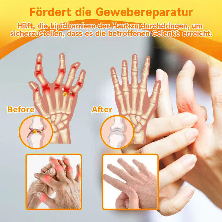 Fivfivgo™ Bienengift- und Kurkuma-Gelenk- und Knochenschmerzlinderungs-Spray (Spezialisiert auf Gelenk- und Arthritisbeschwerden & empfohlen von der AAOS)
