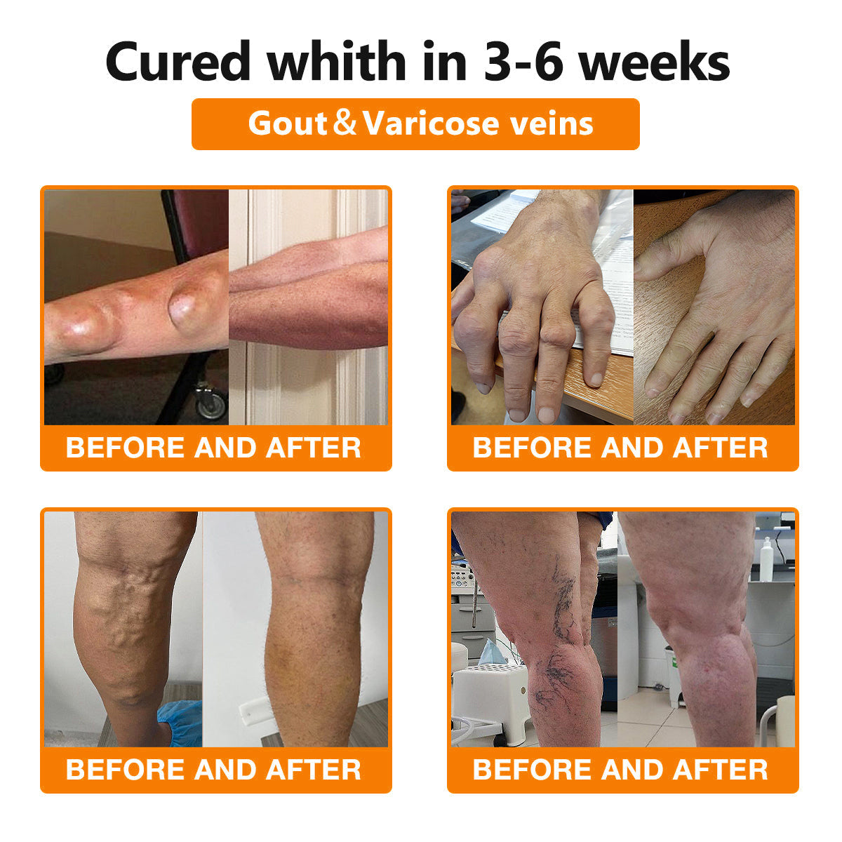 Fivfivgo™ Bee Venom and Turmeric Joint and Bone Pain Relief Cream (Specialized in Joint and Arthritis Pain & Recommended by AAOS)