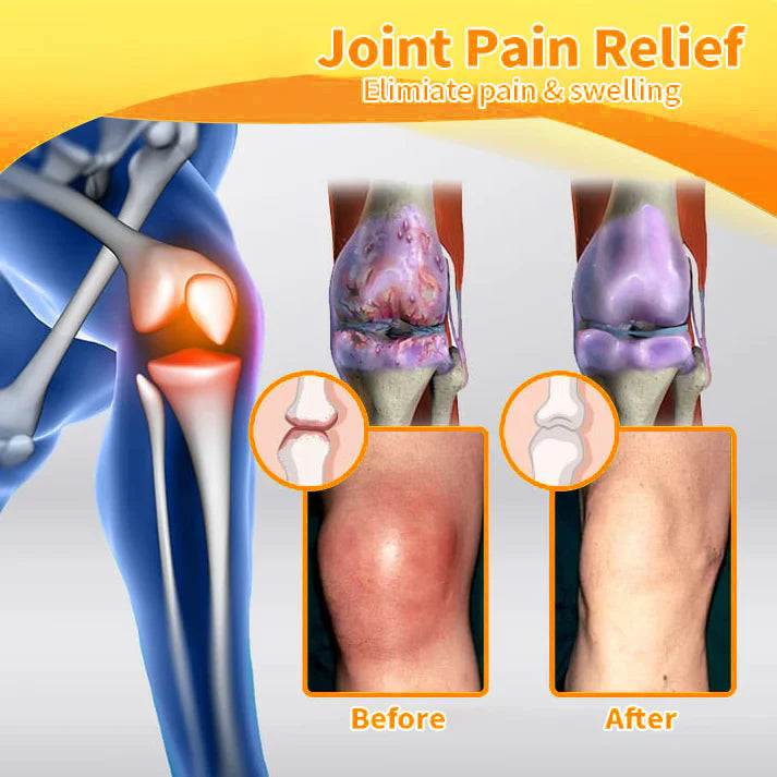 Fivfivgo™ Bee Venom and Turmeric Joint and Bone Pain Relief Cream (Specialized in Joint and Arthritis Pain & Recommended by AAOS)