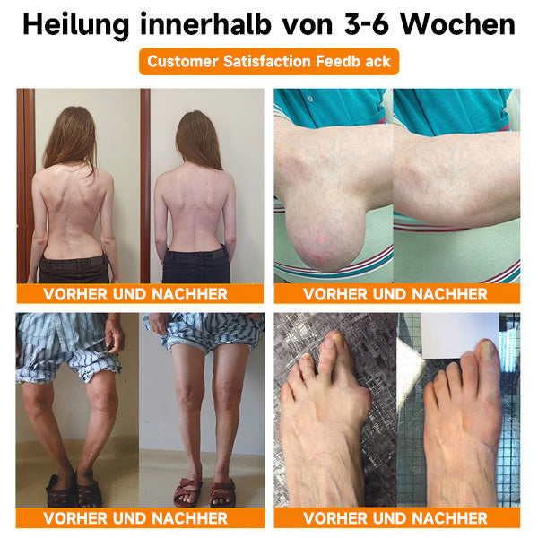 Fivfivgo™ Bienengift- und Kurkuma-Gelenk- und Knochenschmerzlinderungs-Spray (Spezialisiert auf Gelenk- und Arthritisbeschwerden & empfohlen von der AAOS)