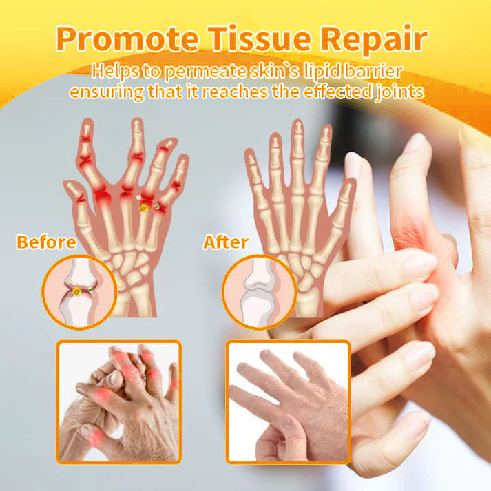 Fivfivgo® Bee Venom and Turmeric Joint and Bone Pain Relief Spray (Specialized in Joint and Arthritis Pain & Recommended by AAOS)