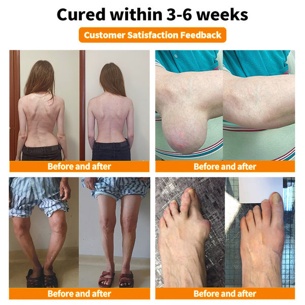 Fivfivgo® Bee Venom and Turmeric Joint and Bone Pain Relief Spray (Specialized in Joint and Arthritis Pain & Recommended by AAOS)