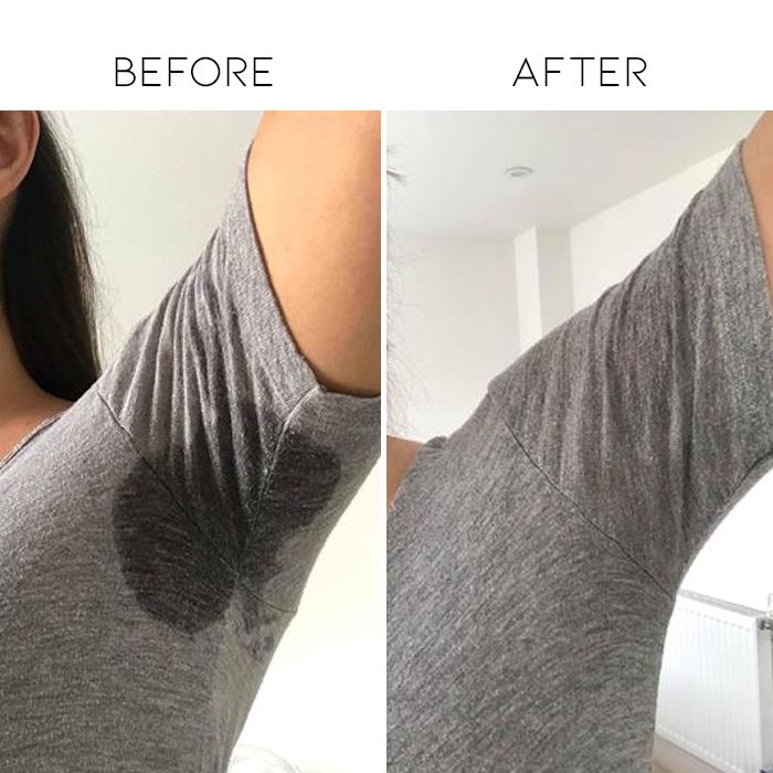 Sweat Absorb Underarm Pads Personal Care Every Day And Night 