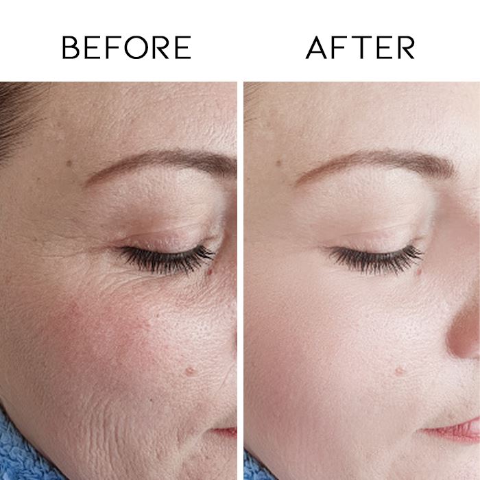 Retinol Anti-Ageing Cream Personal Care Every Day And Night 