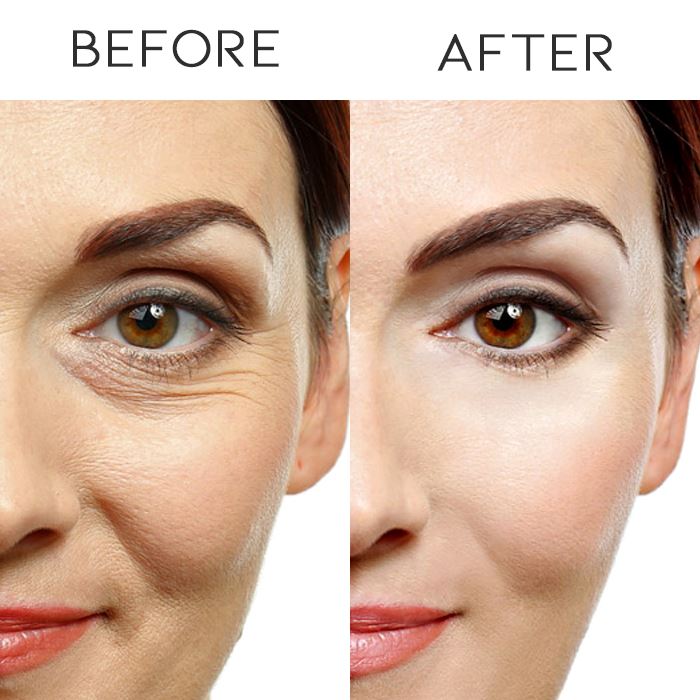 Anti-Wrinkle Eye Cream With Electric Massager Personal Care Every Day And Night 